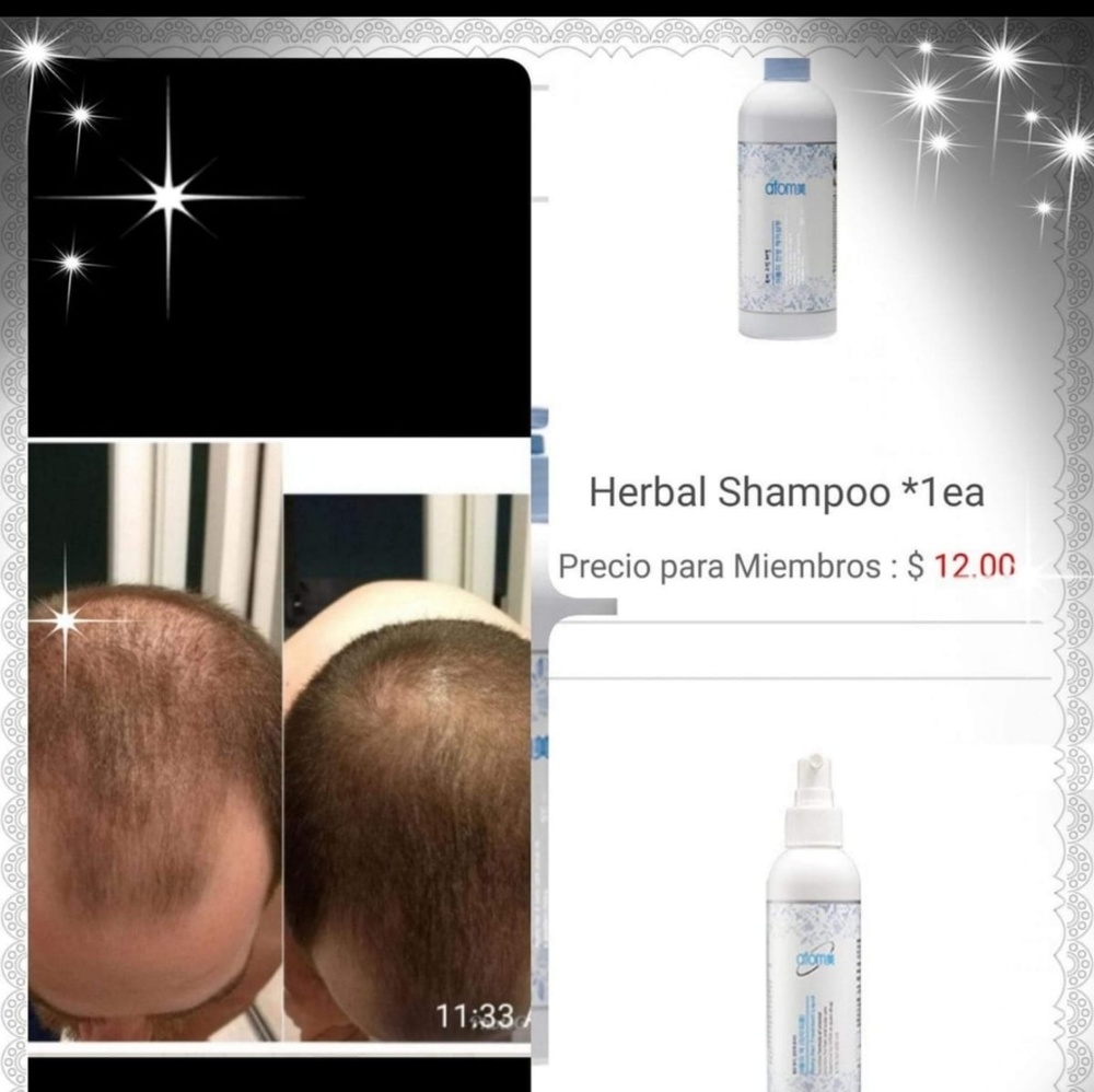 Hair tonic